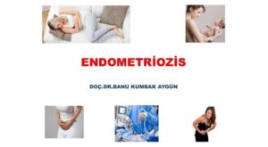 Endometriozis, İBB Eğiticilerin Eğitimi Toplantısı, 2015 2