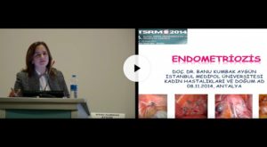 Endometriozis, 6. Ulusal Üreme Endokrinolojisi Ve İnfertilite Kongresi, TSRM Kasım 2014, Antalya 1