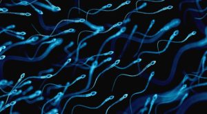 Sperm Morfoloji Bozukluğu İnfertilite Sebebi Midir? Kruger Testi Nedir? 2