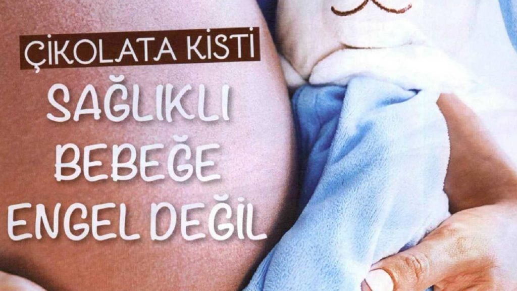 Bebek Dergisi -Çikolata Kisti Sağlıklı Bebeğe Engel Değil – Eylül 2018