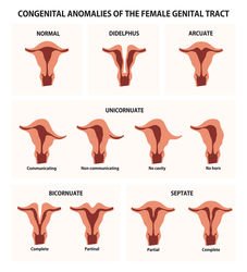 UTERINE ANOMALIES IN INFERTILITY AND IVF