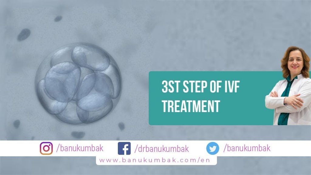 3rd Step of IVF Treatment: Embryo Transfer (ET)-Banu Kumbak Aygün, M.D., Professor