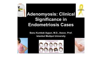Adenomyosis, 2nd European Congress On Endometriosis, November 2013, Berlin